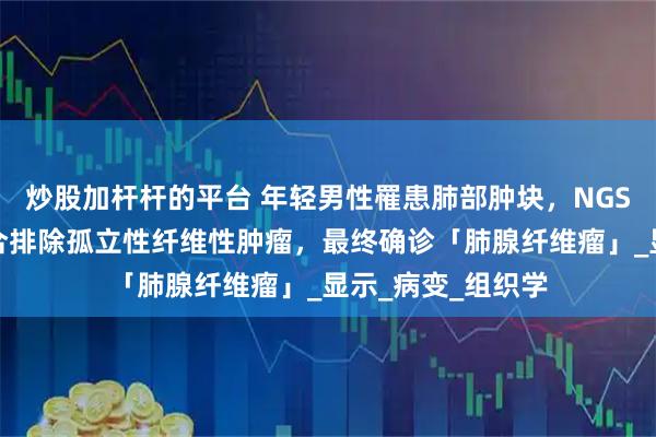 炒股加杆杆的平台 年轻男性罹患肺部肿块，NGS未检出特异性融合排除孤立性纤维性肿瘤，最终确诊「肺腺纤维瘤」_显示_病变_组织学